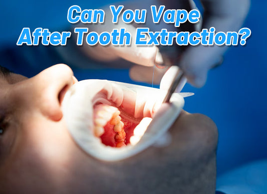 Can You Vape After Tooth Extraction?